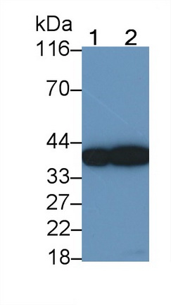 Monoclonal Antibody to Surfactant Associated Protein D (SPD)