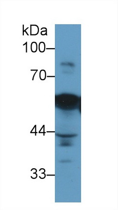 Monoclonal Antibody to Vimentin (VIM)