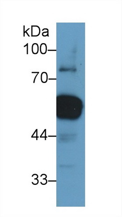 Monoclonal Antibody to Vimentin (VIM)