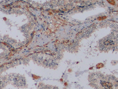 Monoclonal Antibody to Vimentin (VIM)