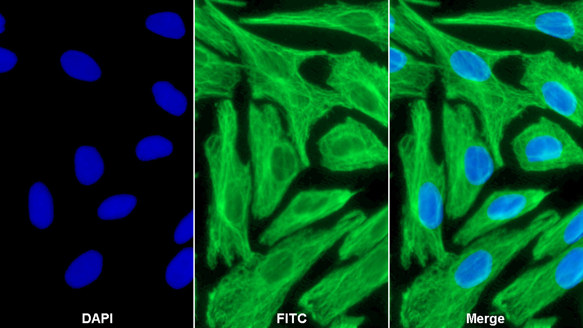 Monoclonal Antibody to Vimentin (VIM)