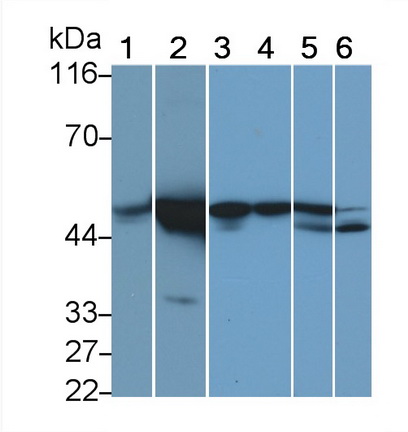 Monoclonal Antibody to Vimentin (VIM)