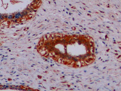 Monoclonal Antibody to Vimentin (VIM)