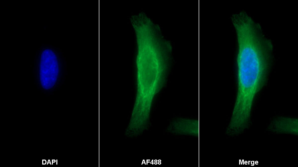 Monoclonal Antibody to Vimentin (VIM)