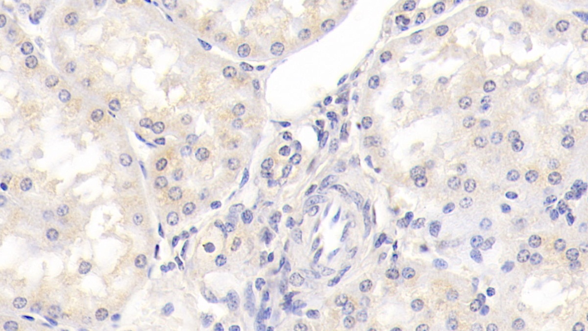 Monoclonal Antibody to Integrin Beta 1 (ITGb1)