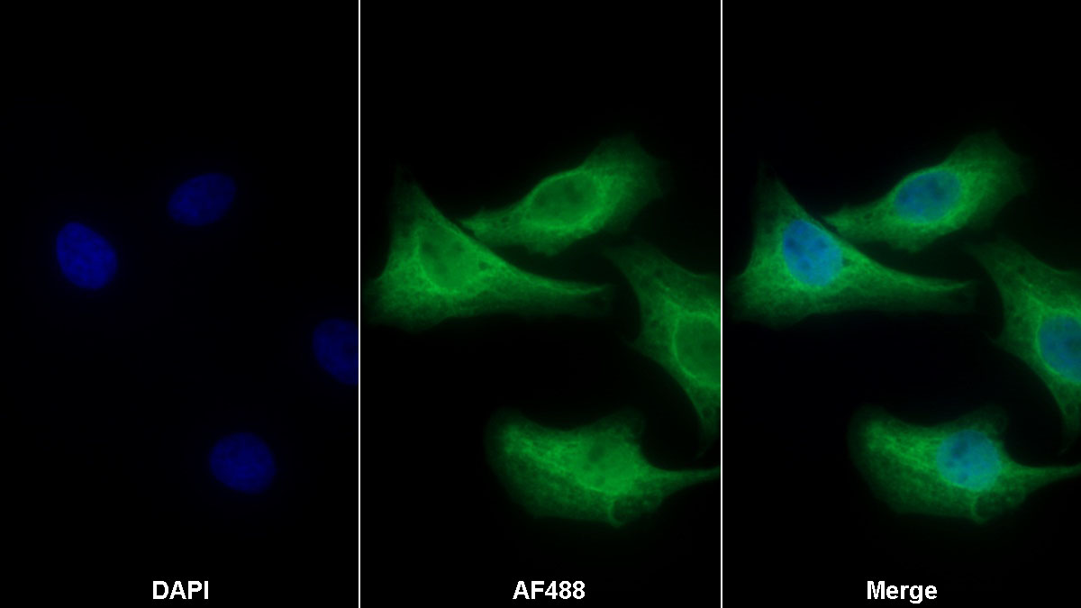 Monoclonal Antibody to Apoptotic Peptidase Activating Factor 1 (APAF1)