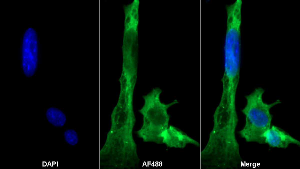 Monoclonal Antibody to Apoptotic Peptidase Activating Factor 1 (APAF1)