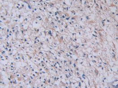 Monoclonal Antibody to Tryptase (TPS)