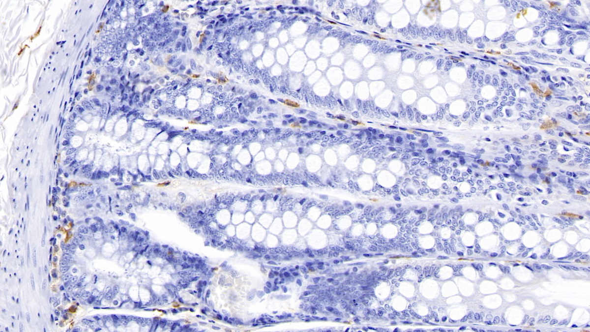 Monoclonal Antibody to Tryptase (TPS)