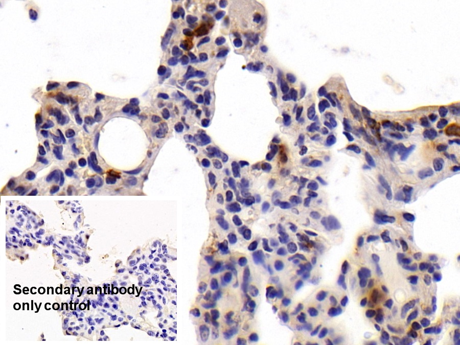 Monoclonal Antibody to Tryptase (TPS)