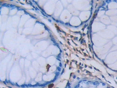 Monoclonal Antibody to Tryptase (TPS)