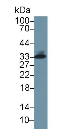 Monoclonal Antibody to Tryptase (TPS)