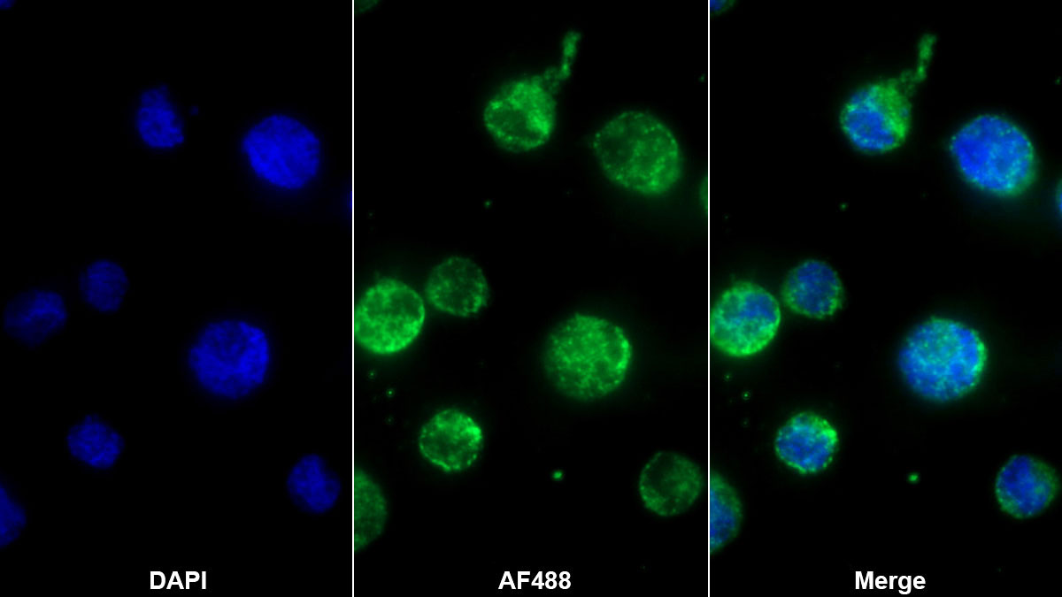 Monoclonal Antibody to S100 Calcium Binding Protein A12 (S100A12)