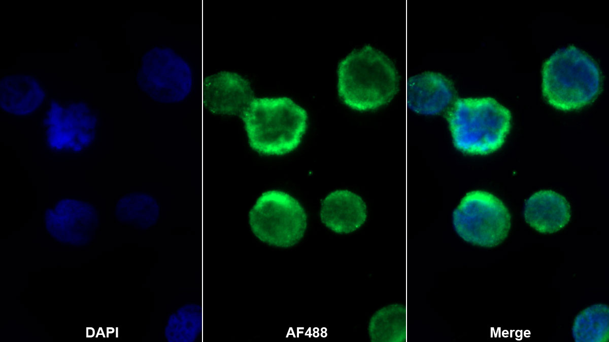 Monoclonal Antibody to S100 Calcium Binding Protein A12 (S100A12)