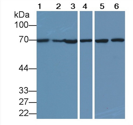 Monoclonal Antibody to Heat Shock 70kDa Protein 1A (HSPA1A)