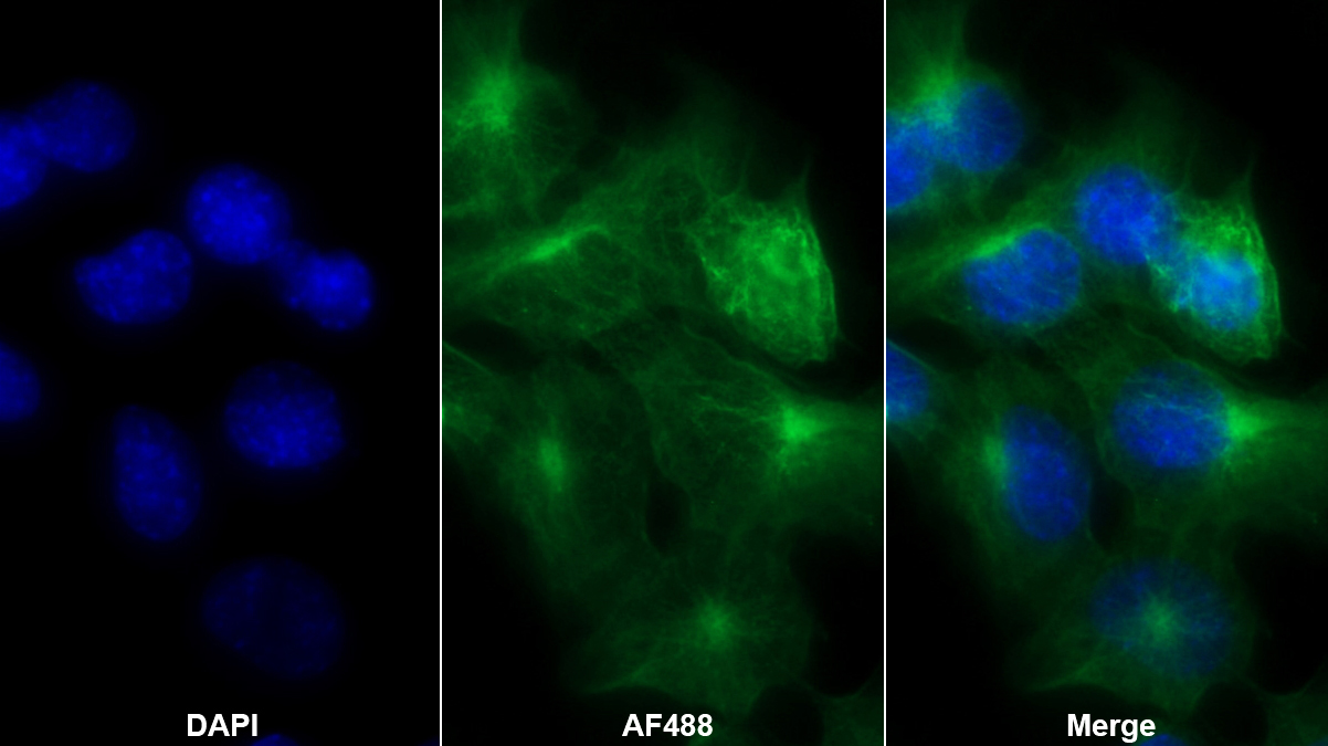 Monoclonal Antibody to Glutathione S Transferase Pi (GSTp)