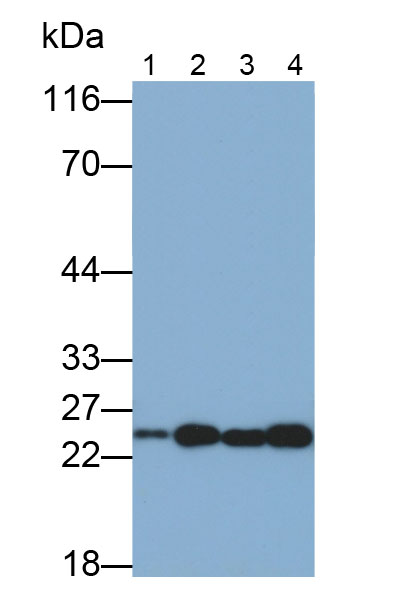 Monoclonal Antibody to Glutathione S Transferase Pi (GSTp)