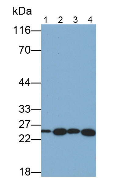 Monoclonal Antibody to Glutathione S Transferase Pi (GSTp)