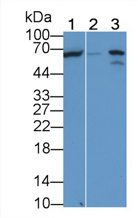 Monoclonal Antibody to Alkaline Phosphatase, Tissue-nonspecific (ALPL)