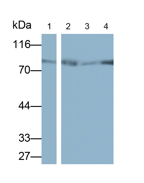 Monoclonal Antibody to Alkaline Phosphatase, Tissue-nonspecific (ALPL)