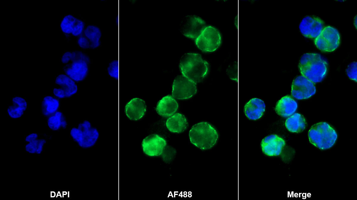 Monoclonal Antibody to Cluster Of Differentiation 8a (CD8a)