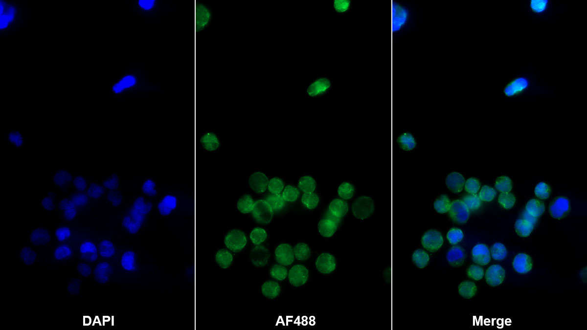 Monoclonal Antibody to Cluster Of Differentiation 8a (CD8a)