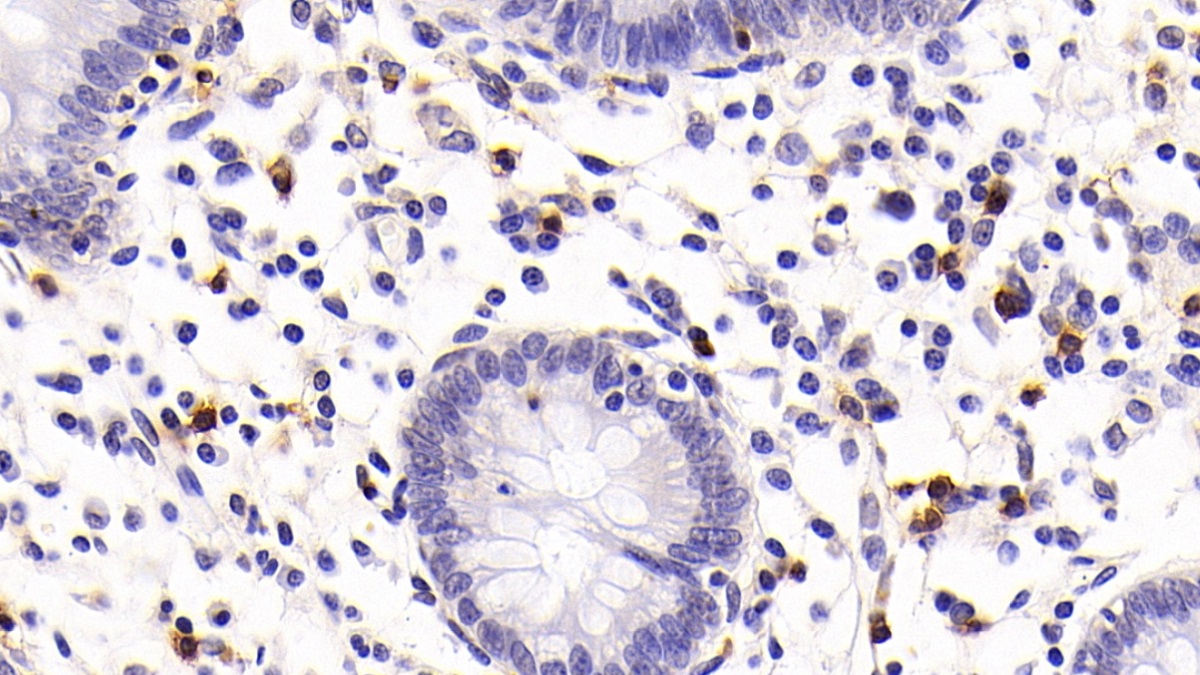 Monoclonal Antibody to Cluster Of Differentiation 8a (CD8a)