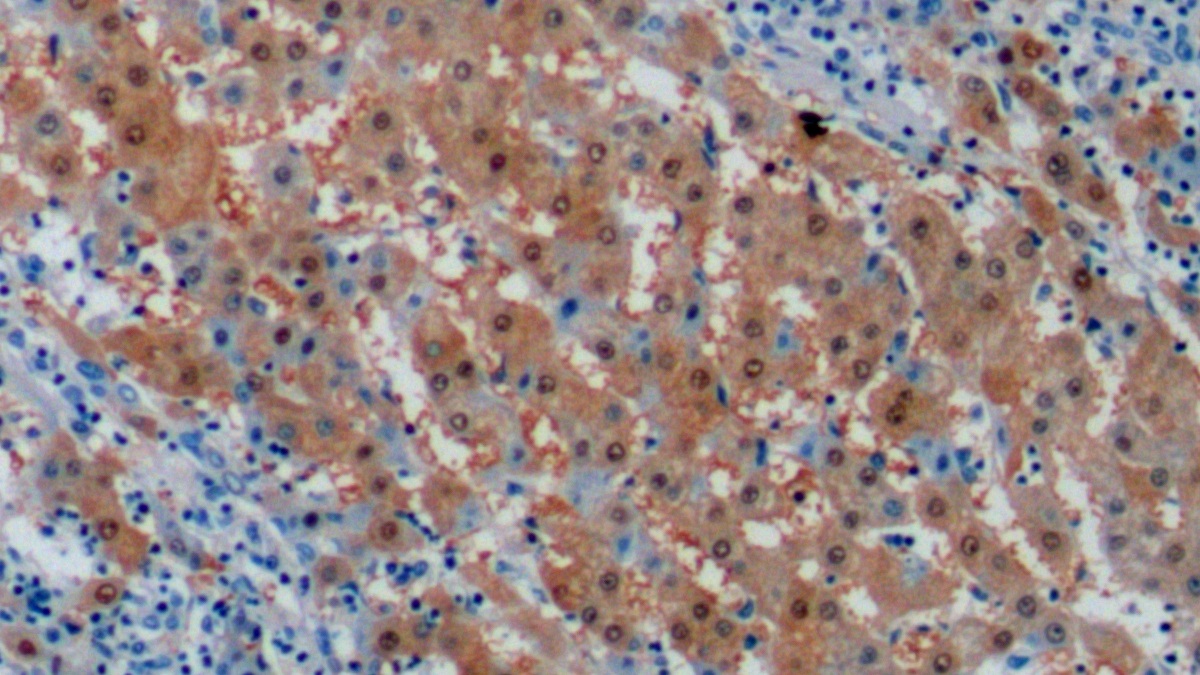 Monoclonal Antibody to Arginase (ARG)