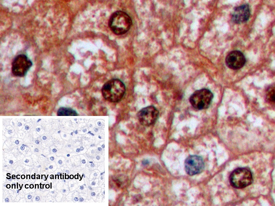 Monoclonal Antibody to Arginase (ARG)