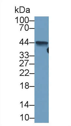 Monoclonal Antibody to Arginase (ARG)