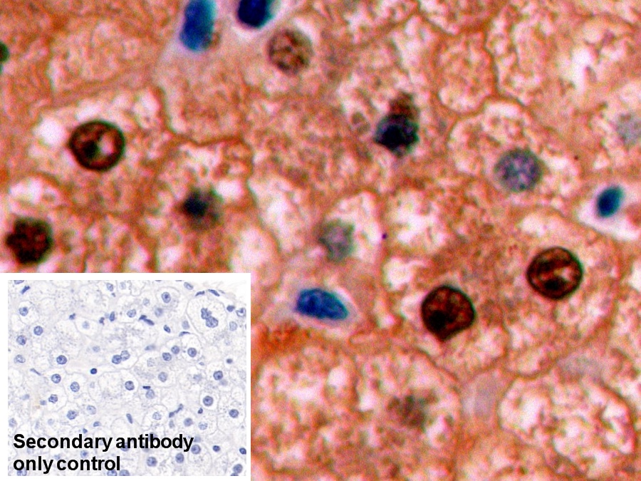 Monoclonal Antibody to Arginase (ARG)