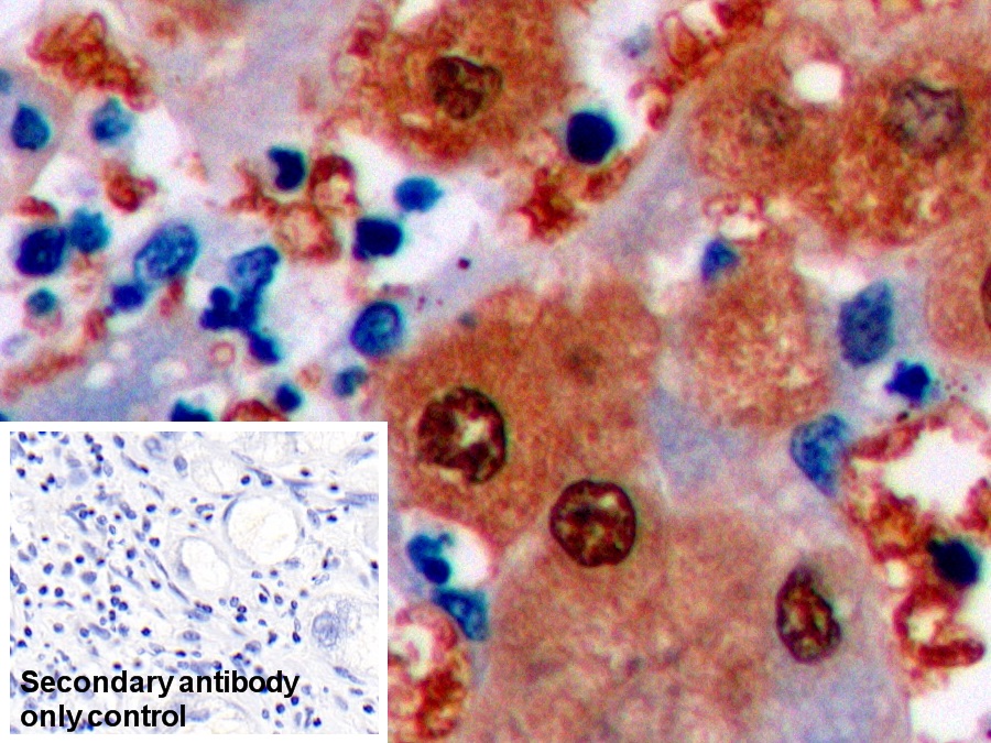 Monoclonal Antibody to Arginase (ARG)