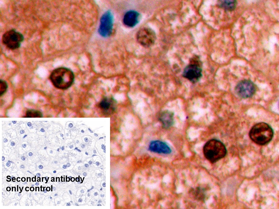 Monoclonal Antibody to Arginase (ARG)