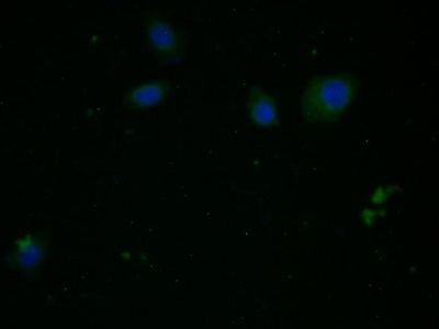 Monoclonal Antibody to Arginase (ARG)