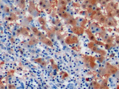 Monoclonal Antibody to Arginase (ARG)