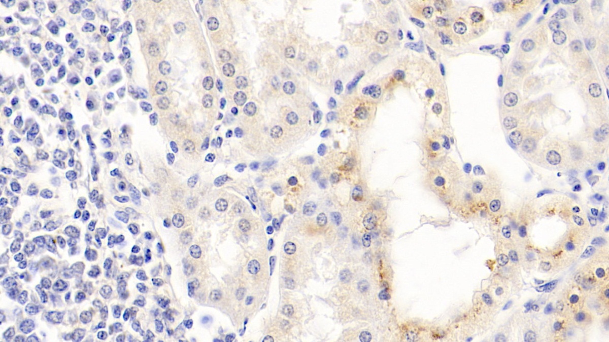 Monoclonal Antibody to Arginase (ARG)