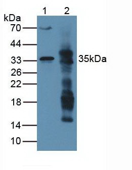 Monoclonal Antibody to Arginase (ARG)