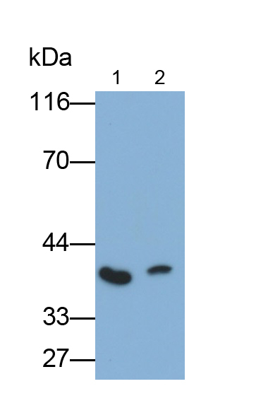 Monoclonal Antibody to Arginase (ARG)