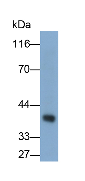 Monoclonal Antibody to Arginase (ARG)