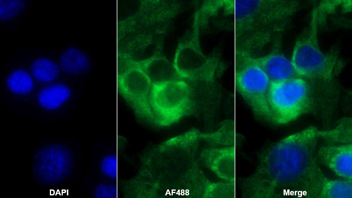 Monoclonal Antibody to Arginase (ARG)