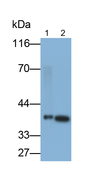 Monoclonal Antibody to Arginase (ARG)