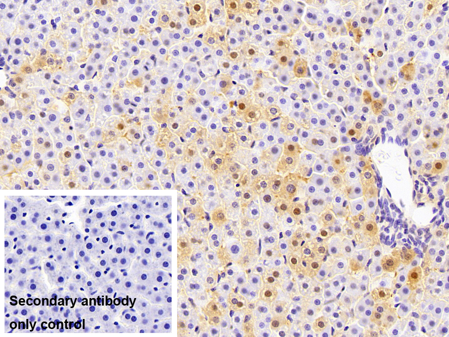 Monoclonal Antibody to Arginase (ARG)