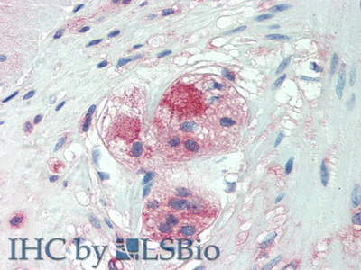 Monoclonal Antibody to Chondroitin Sulfate Proteoglycan 4 (CSPG4)