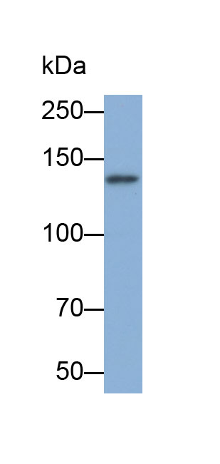 Monoclonal Antibody to Sialic Acid Binding Ig Like Lectin 2 (CD22)