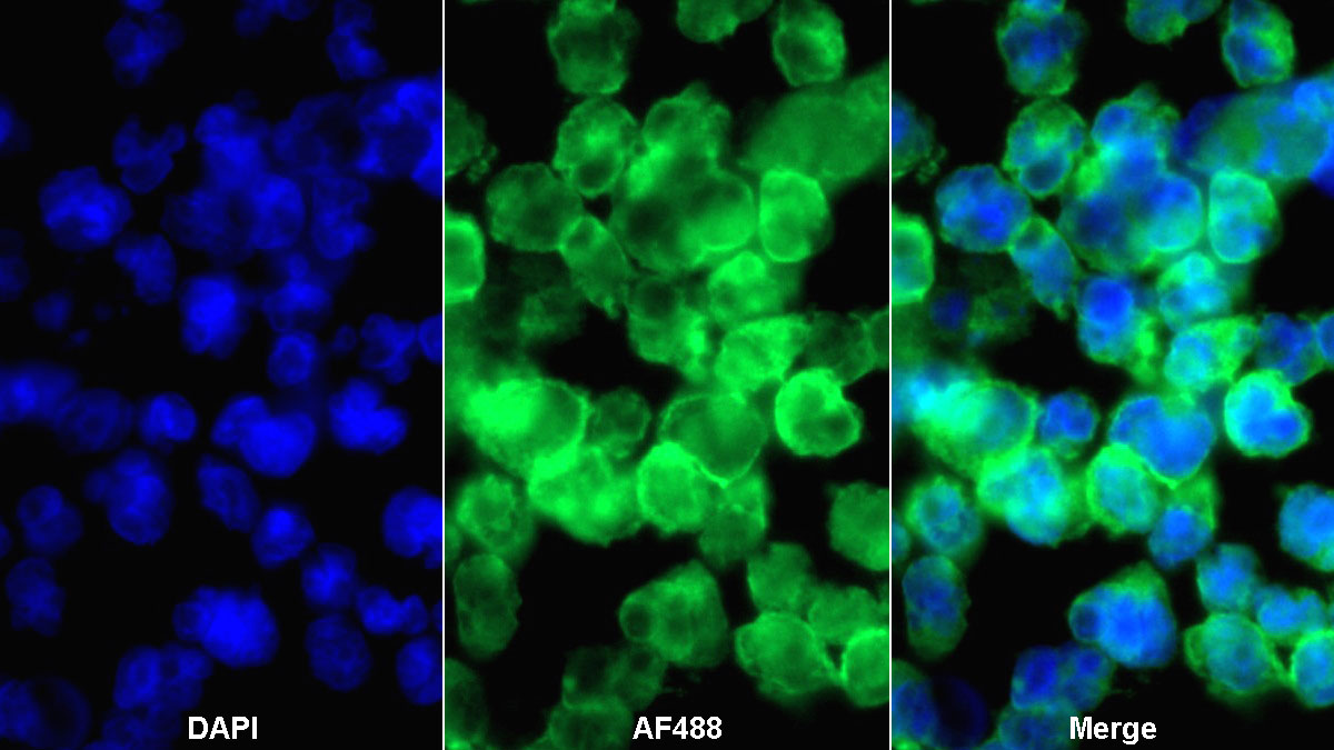 Monoclonal Antibody to Sialic Acid Binding Ig Like Lectin 2 (CD22)