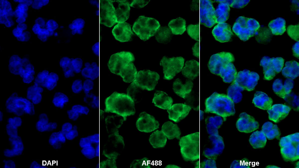 Monoclonal Antibody to Sialic Acid Binding Ig Like Lectin 2 (CD22)