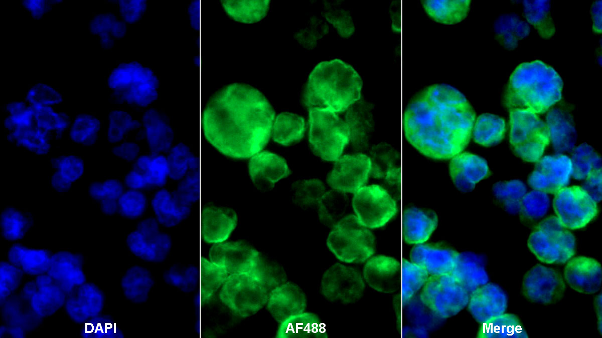 Monoclonal Antibody to Sialic Acid Binding Ig Like Lectin 2 (CD22)