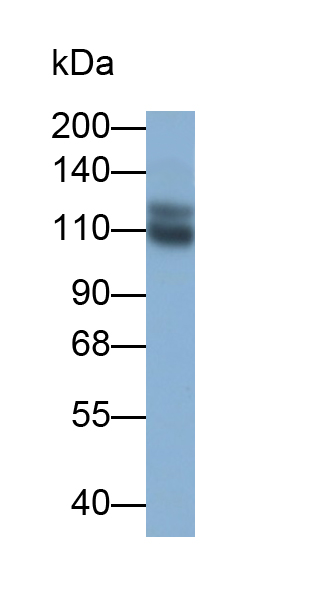 Monoclonal Antibody to Sialic Acid Binding Ig Like Lectin 2 (CD22)