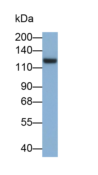 Monoclonal Antibody to Sialic Acid Binding Ig Like Lectin 2 (CD22)