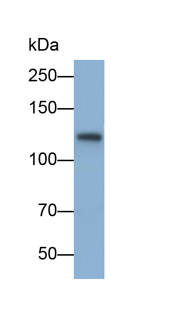 Monoclonal Antibody to Sialic Acid Binding Ig Like Lectin 2 (CD22)